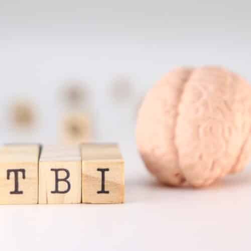 *NEW* Traumatic Brain Injury: An Overview of Etiology, Symptoms, and Treatment